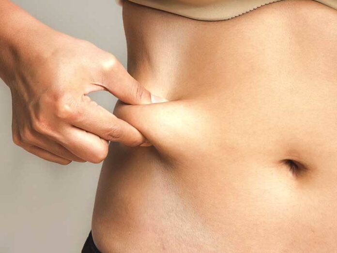 CoolSculpting
