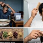 Teenage Hair Loss: My Hostel Story and the Truth About Hair Care teenage hair fall